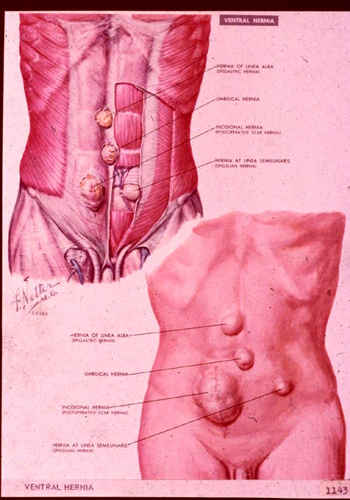 Гардероб Vental