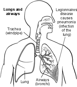 LEGIONNAIRES DISEASE – Symptoms, Causes, Tests, Prevention and ...