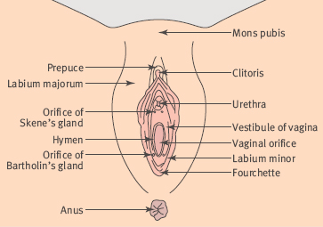 cyst labia majora