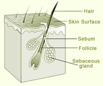 sebaceous-glands-pictures.jpg