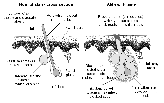 the Sebaceous Glands which