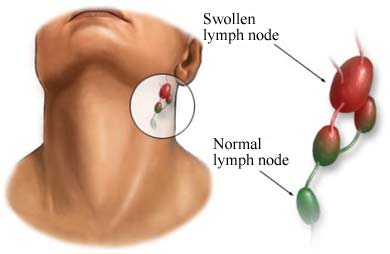 Nodes Throat 36