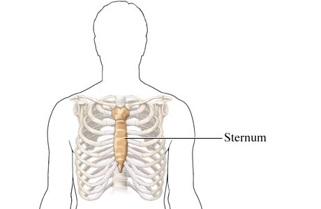 Sternum (Breastbone) Pain - Causes, Diagnosis and Treatments