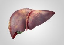 sick human liver with cancer isolated