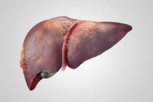 sick human liver with cancer isolated