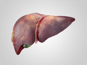 sick human liver with cancer isolated