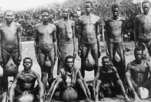 Elephantiasis pictures (balls)