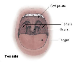 Swollen Uvula structure