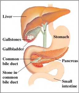 symptoms of Acute Pancreatits 2