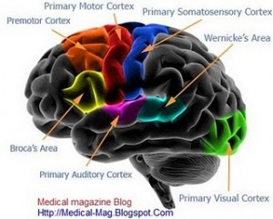 Huntington's disease pictures