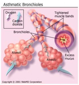 Asthmatic Bronchitis Pictures