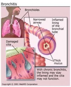 Bronchitis pictures