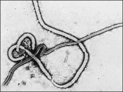 Ebola Virus Photos