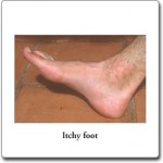 top of feet itch at night top of feet itch at night