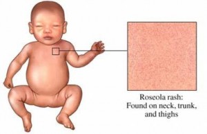 roseola rash images