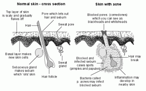 sebum pictures