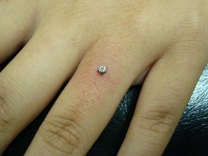 Pictures of dermal anchor piercing