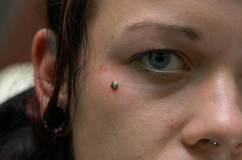 Dermal Anchor Piercing photos