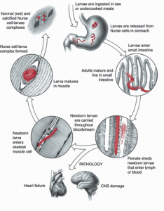 Trichinosis photos