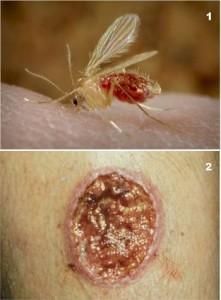 photos of Leishmaniasis