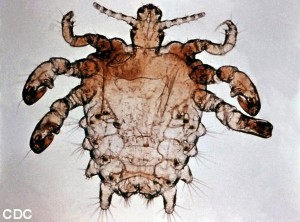 pictures of pubic lice