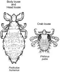 pubic lice crabs