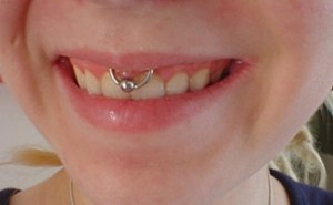 Smiley Piercing images