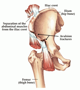 Iliac Crest Images