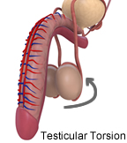Pictures of Testicular Torsion