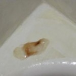 mucous plug mucous plug