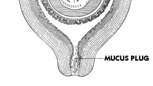 pictures of Mucus Plug