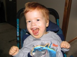 Images of Canavan Disease