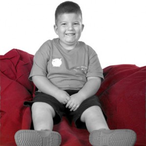 Prader Willi Syndrome Images