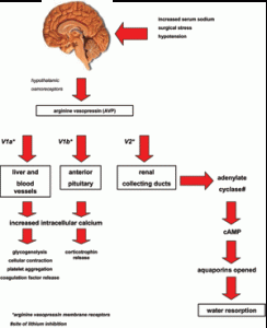 Picture of Nephrogenic Diabetes Insipidus