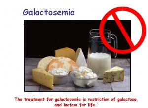 Image of Galactosemia