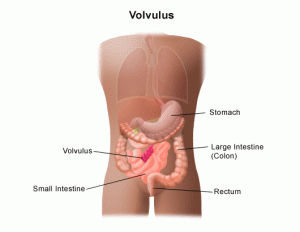 Image of Volvulus
