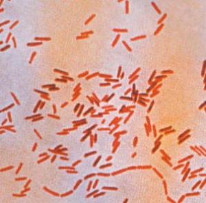 Image of Salmonellosis