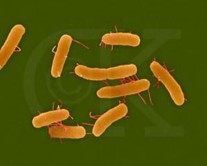 Picture of Salmonellosis