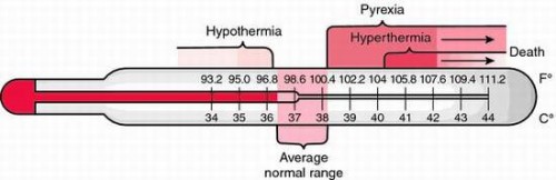 Hypothermia Hyperthermia on Celsius and Fahrenheit thermometers