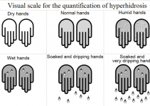 hyperidrosis