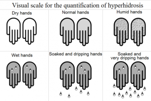 hyperidrosis